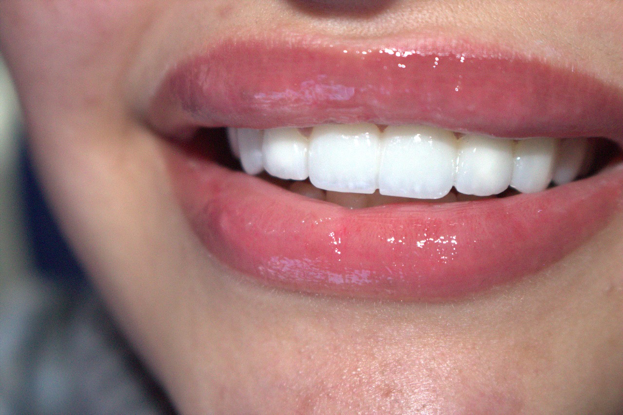 ابتسامة جميلة